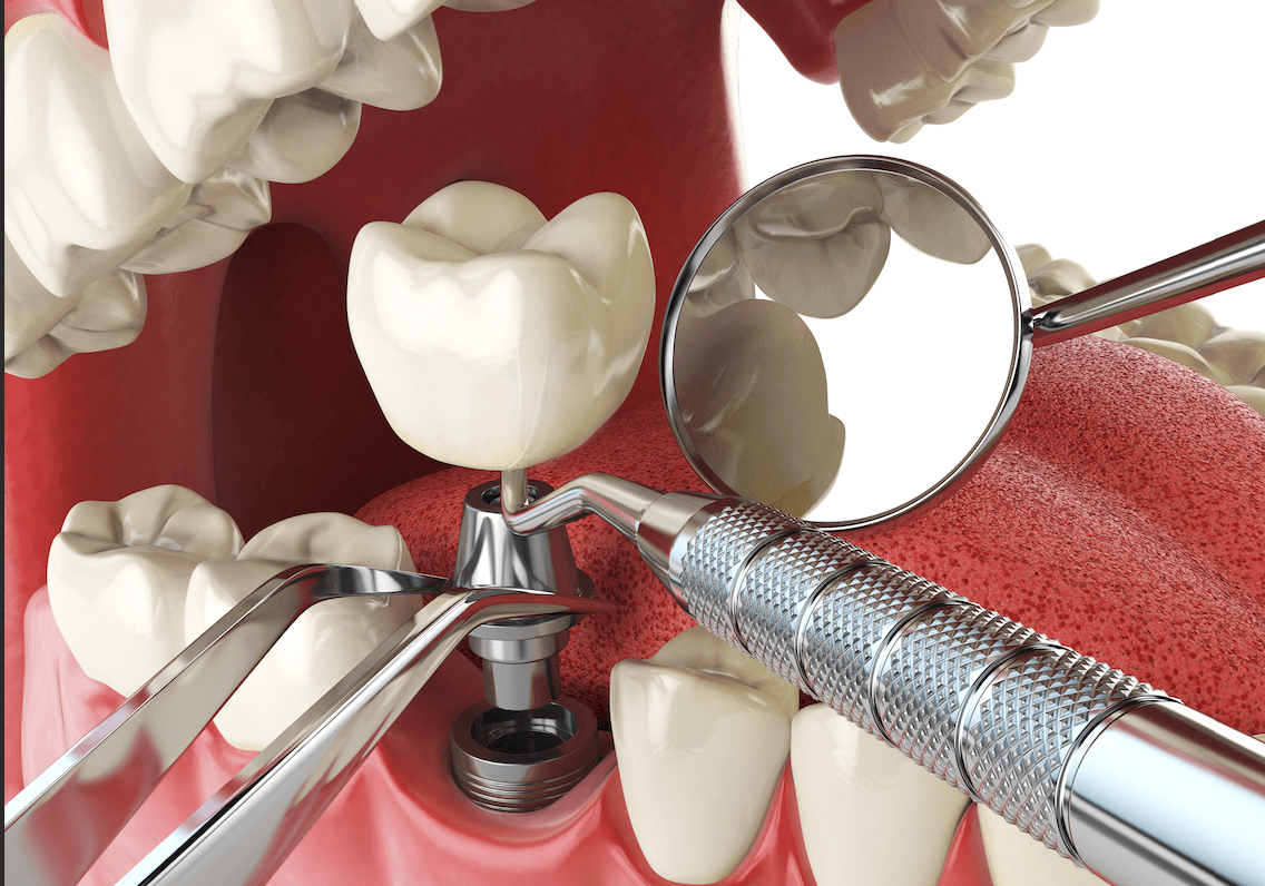 A female student is smiling as she looks down to her laptop, as she has her hands hovering slightly over its keyboard.