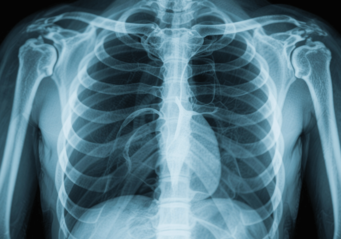 A female student is smiling as she looks down to her laptop, as she has her hands hovering slightly over its keyboard.